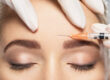 Botox Cosmetic FAQ’s | Vina Laser Med Spa