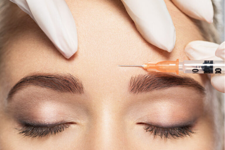 Botox Cosmetic FAQ’s | Vina Laser Med Spa