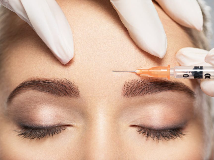 Botox Cosmetic FAQ’s | Vina Laser Med Spa