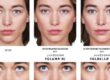 Everything You Need to Know About Juvéderm | Vina Laser Med Spa | Saginaw, Michigan