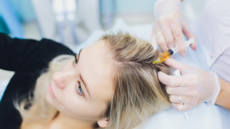 How Platelet-Rich Plasma (PRP) Therapy Enhances Hair Restoration | Vina Laser Med Spa