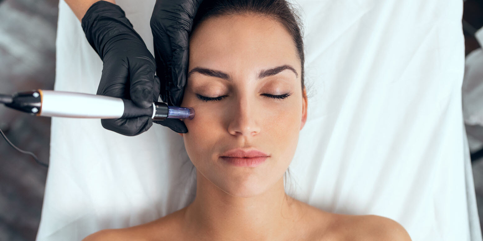 Rejuvenate Your Skin with Microneedling | Vina Laser Med Spa