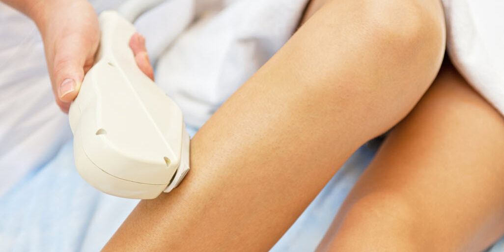 Tips for Successful Laser Hair Removal | Vina Laser Med Spa