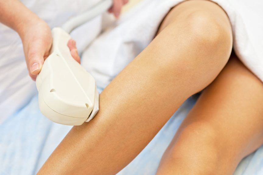 Tips for Successful Laser Hair Removal | Vina Laser Med Spa